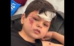تصاویر این کودک فلسطینی طی ساعات اخیر پربازدید شد 1 d8aad8b5d8a7d988db8cd8b1 d8a7db8cd986 daa9d988d8afdaa9 d981d984d8b3d8b7db8cd986db8c d8b7db8c d8b3d8a7d8b9d8a7d8aa d8a7d8aedb8cd8b1 d9be 680b9243b699d