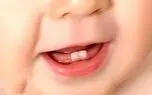 d988db8cd8aad8a7d985db8cd986db8c daa9d987 d8afd986d8afd8a7d986d987d8a7db8c d8b4d985d8a7 d8b1d8a7 d8a7d8b2 d9bed988d8b3db8cd8af 681a42499f4dd